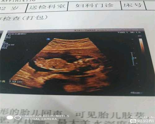 国内供卵犯法吗_上海供卵试管被骗怎么办_输卵管不通降低女性生育能力