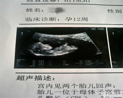 上海妇幼有没有供卵的_供卵自怀瓒 上海坤和_过试管今天医生说卵泡多喊我捐卵