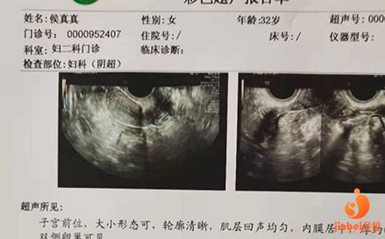 45岁卵巢早衰中医调理&供卵需要多少钱&【中国有供卵试管婴儿吗】希望大家孕